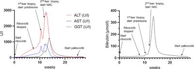 Ribociclib-induced liver injury: a case report